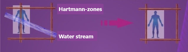 Hartmann zones picture